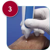 Utilisation CryOmega Etape 3