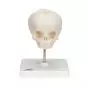 Crâne de fœtus A26