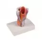 Modèle de larynx en 2 parties G223 Erler Zimmer