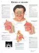 Planche anatomique Rhinite et sinusite VR2251L
