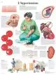 Planche anatomique L'hypertension VR2361UU