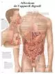 Planche anatomique Affections de L'appareil digestif VR2431UU