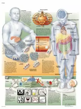 Planche anatomique Le diabète VR2441UU