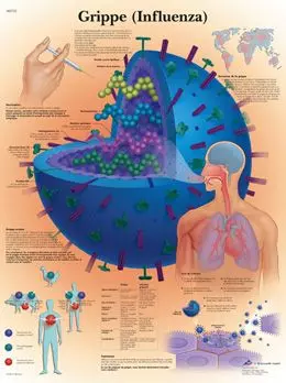 Planche anatomique Grippe (Influenza) VR2722UU