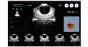Bladder scanner / Scanner vésical portable Peaksonic BladderView M4