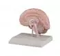 Section droite du cerveau humain C215 Erler Zimmer