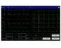 Electrocardiographe ECG Contec 600G 6 pistes avec interprétation
