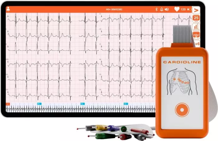 Electrocardiographe ECG Cardioline Touchecg HD+ Bluetooth (12 pistes) pour Android avec tablette 10"