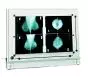 Négatoscope de mammographie à LED DXHM avec variateur ( 1,2,3,4,5 plages)
