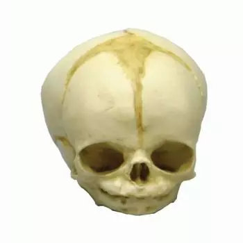 Modèle de crâne de fœtus de 32 semaines 4750 Erler Zimmer