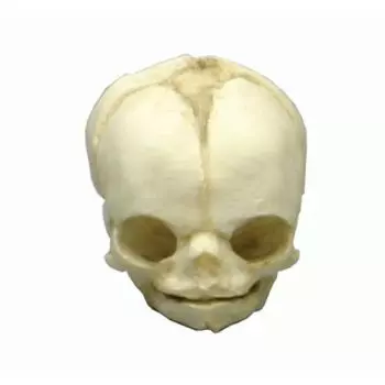 Modèle de crâne de fœtus de 21 semaines ½ 4762 Erler Zimmer