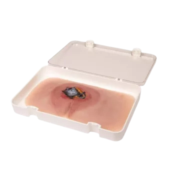 Modèle de plaie décubitus sacré non traité Erler Zimmer