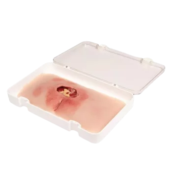 Modèle de plaie décubitus sacré nettoyé Erler Zimmer