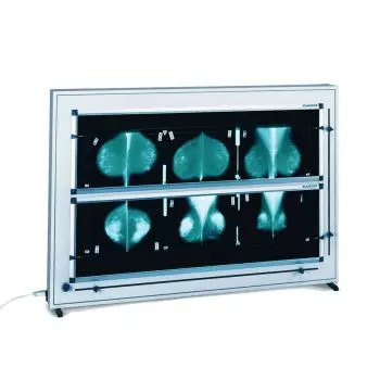 Négatoscope de mammographie à LED DXHM avec variateur ( 1,2,3,4,5 plages)