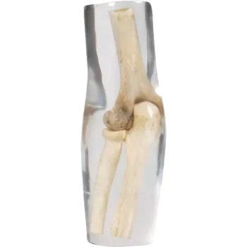 Fantôme radiographique du coude Erler Zimmer