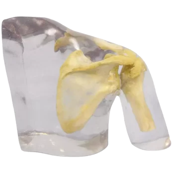 Fantôme radiographique de l'épaule Erler Zimmer