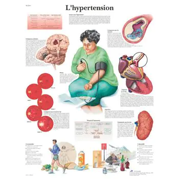 Planche anatomique L'hypertension VR2361L