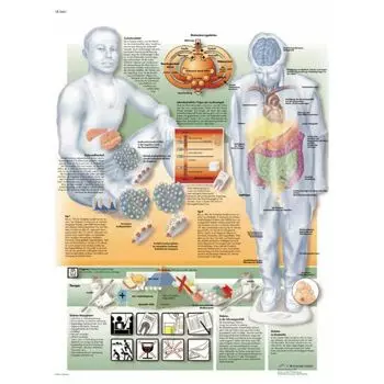 Planche anatomique Le diabète VR2441L