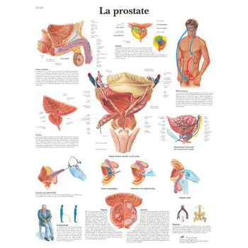 Planche anatomique La prostate VR2528UU