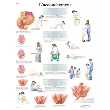 Planche anatomique L'accouchement VR2555UU