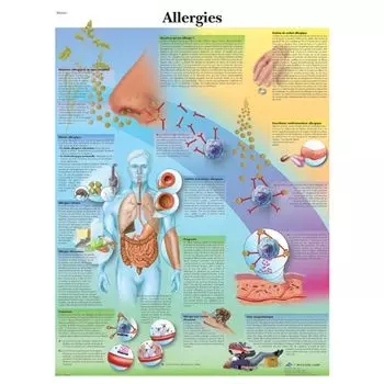 Planche anatomique Allergies VR2660L