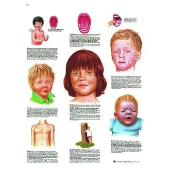 Planche anatomique Les maladies infantiles VR2741L
