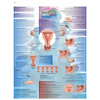 Planche anatomique La contraception VR2591L