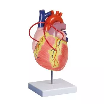 Cœur avec pontage coronarien grossi 2 fois G206 Erler Zimmer
