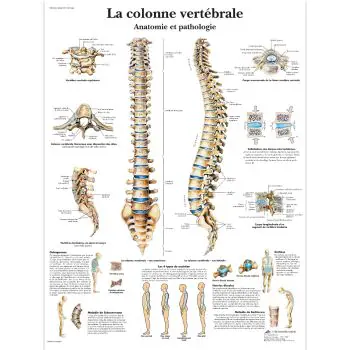 Planche anatomique La colonne vertébrale, Anatomie et pathologie VR2152L