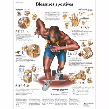 Planche anatomique blessures sportives VR2188L 3B Scientific