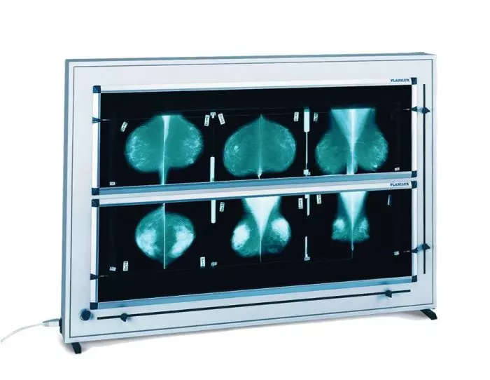 Négatoscope de mammographie à LED DXHM avec variateur ( 1,2,3,4,5 plages)