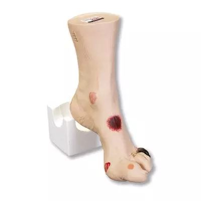 Modèle de Pied blessé Wilma™ 3B Scientific W46516