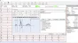 ECG numérique Spengler Cardiomate PC-ECG (12 pistes)