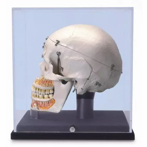 Crâne de démonstration de luxe, avec vitrine A27/9