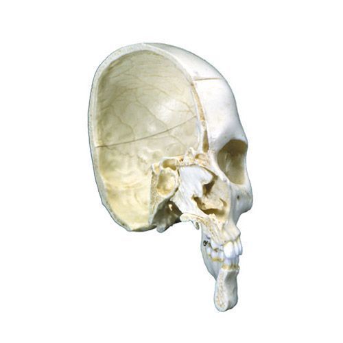 Hémi-crâne avec structures osseuses, 4 parties A280