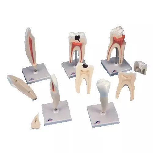 Série de 5 modèles de dents D10