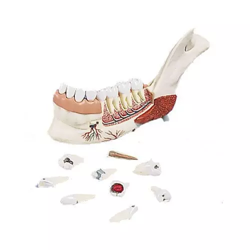 Hémi-mandibule, avec 8 dents cariées, en 19 parties VE290