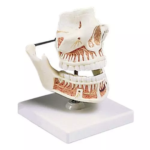 Dentition adulte VE281