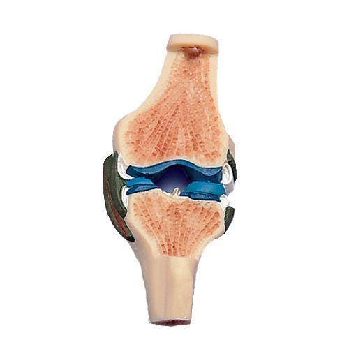 Sezione dell’articolazione del ginocchio W19006