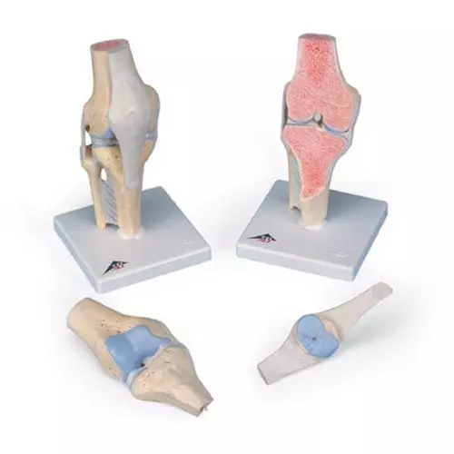Modèle de coupe de l'articulation du genou, en 3 parties A89