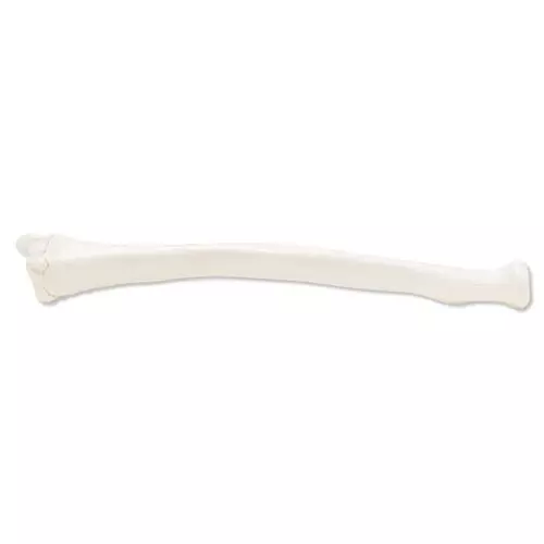 Radius, gauche A45/3