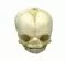 Modèle de crâne de fœtus de 21 semaines ½ 4762 Erler Zimmer
