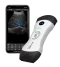 Echographe ultraportable connecté Bionet SonoMe
