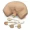 Simulateur d’examen de la prostate W44014 3B Scientific