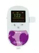 Doppler foetal et vasculaire Spengler