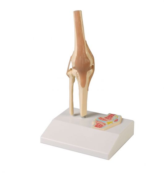 Articulation miniature du genou avec coupe transversale 4522 Erler Zimmer
