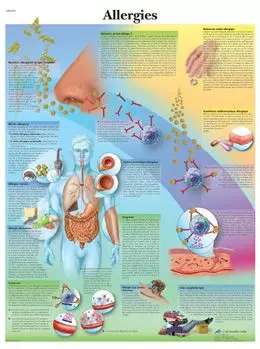 Planche anatomique Allergies VR2660L