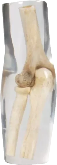 Fantôme radiographique du coude Erler Zimmer