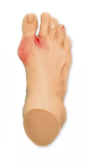 Modèle de blessures courantes du pied R10035 Erler Zimmer