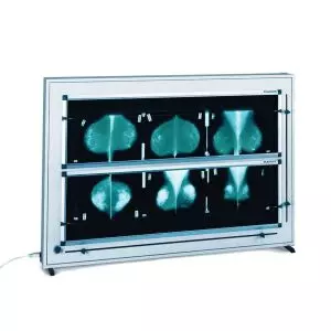 Négatoscope de mammographie à LED DXHM avec variateur ( 1,2,3,4,5 plages)